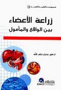 زراعة الأعضاء بين الواقع والمأمول