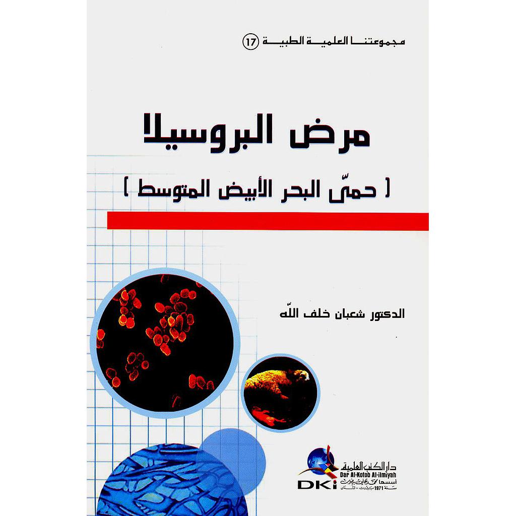 مرض البروسيلا (حمى البحر الأبيض المتوسط)