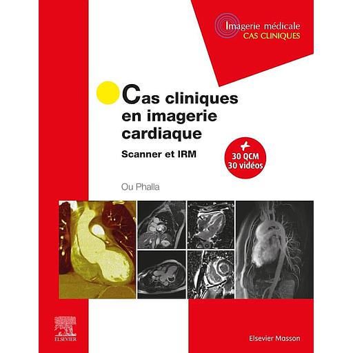 Cas cliniques en imagerie cardiaque  - Scanner et IRM - Campus