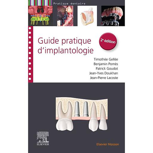 Guide pratique d'implantologie