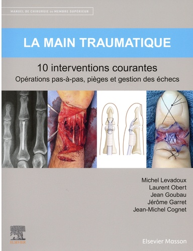 La main traumatique - 10 interventions courantes