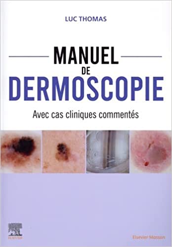 MANUEL DE DERMOSCOPIE - 19 CAS CLINIQUES COMMENTES - CAMPUS