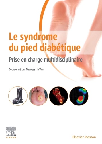 Le syndrome du pied diabétique - Prise en charge multidisciplinaire
