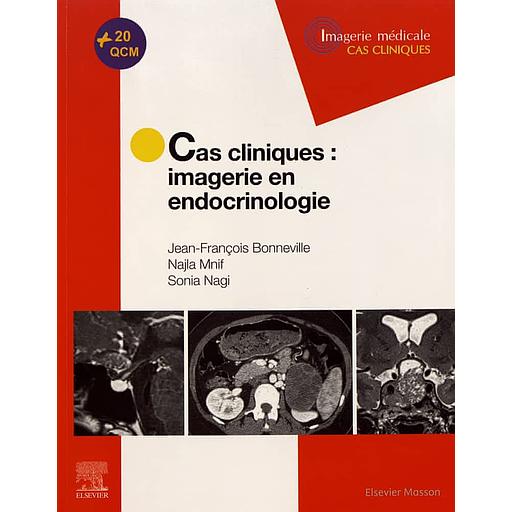 Cas cliniques : imagerie en endocrinologie