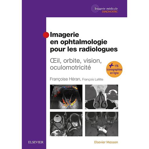 Imagerie en ophtalmologie pour les radiologues  - Oeil, orbite, vision, oculomotricité