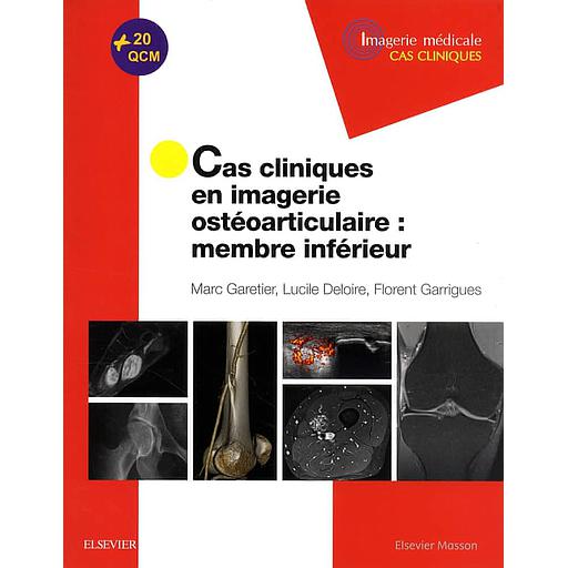 Cas cliniques en imagerie ostéoarticulaire - Membre inférieur