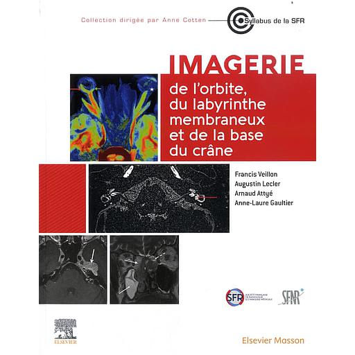 Imagerie de l'orbite, du labyrinthe membraneux et de la base du crâne