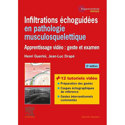 Infiltrations échoguidées en pathologie musculosquelettique  - Apprentissage vidéo : geste et examen