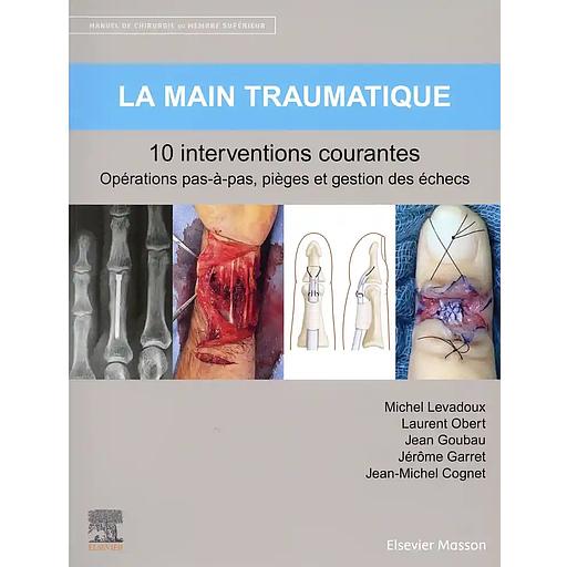 La main traumatique