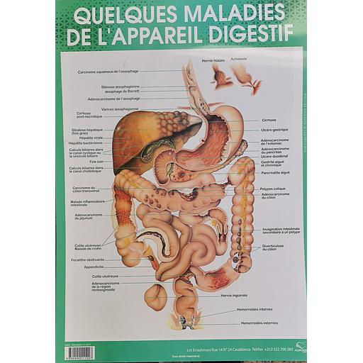 [9780000111227] Poster "Quelques maladies de l'appareil digestif"